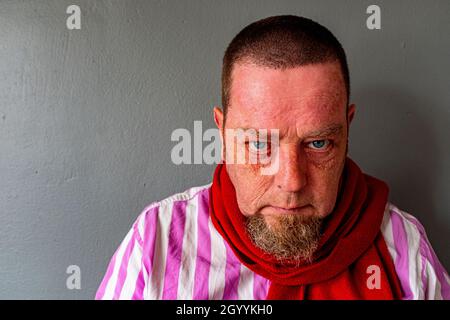 Tilburg, Netherlands. Self Portrait of an Angry Man in front of a Grey, Studio Wall. He is angry due to financial developments within the industry of Photo Journalism, where royalties are in huge decline. Stock Photo