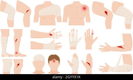 Cartoon physical injury, wound bandage application concept. Open and bandaged human body parts, treated wounds, fractures vector illustration. Human Stock Vector