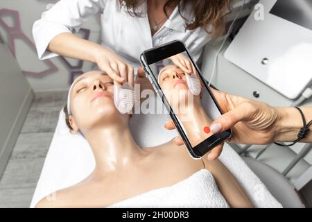 Hand holding smartphone making online live video stream of cosmetician doctor facial care procedure tutorial for online workshop master class in Stock Photo