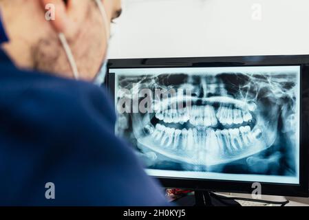 Medical dentist examining a panoramic x-ray on a computer screen in a dental clinic. Stock Photo