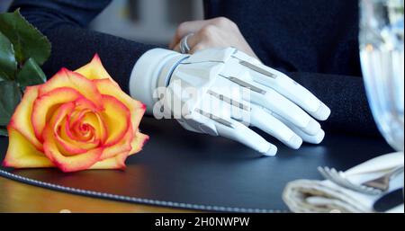 A photo of a hand prosthesis Stock Photo