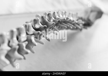 curvature of a human spine Stock Photo