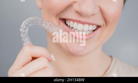 Close-up portrait of a woman putting on a transparent plastic retainer. A girl corrects a bite with the help of an orthodontic device Stock Photo
