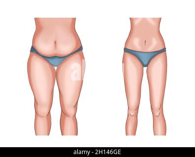 Illustration before and after losing weight Stock Photo