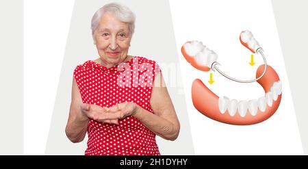 Removable flexible nylon denture on senior female hands. Dental skeletal prosthesis with porcelain crowns was created by author Stock Photo