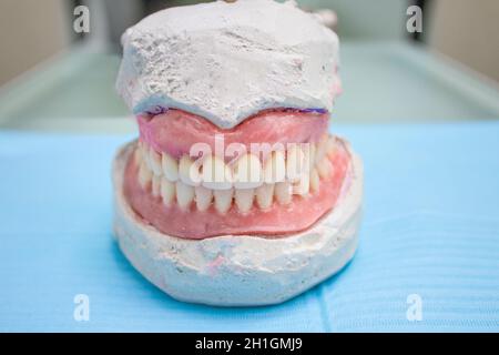 False prostheses. Dental hygienist checkup concept. Full removable plastic denture of the jaws. Stock Photo