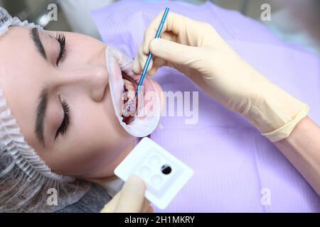 Preparation of the oral cavity before professional teeth cleaning. The dentist applies a purple gel to the patient's teeth.Prevention of caries and gu Stock Photo