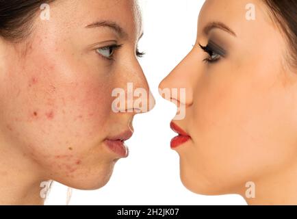 Comparison portrait of a woman without and with makeup and cosmetics procedure on white background Stock Photo