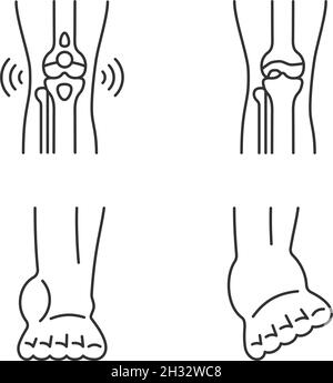 Leg ankle pain thin line icon. Foot joint bones injury outline style ...