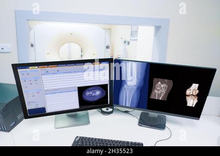 Close up Computer monitor Scan control room and computer showing knee scan fracture, Medical technology concept Stock Photo