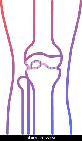 Osteoarthritis gradient linear vector icon Stock Vector