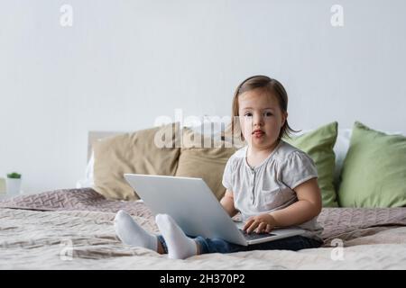 Toddler kid with down syndrome using laptop on bed at home Stock Photo