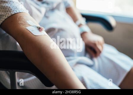 Close-up of an intravenous line in a patient's arm. Stock Photo