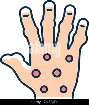 Psoriatic arthritis RGB color icon Stock Vector