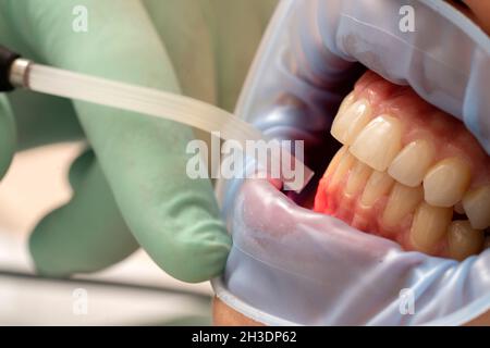 dental therapy with red LED light in the dental office Stock Photo