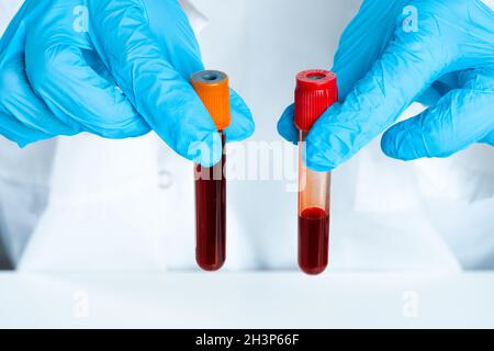 Doctor's hands in blue gloves keep test tube with a blood Stock Photo