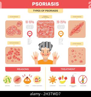 Psoriasis infographic. Human skin infection psoriasis diagnosis vector medical pictures Stock Vector