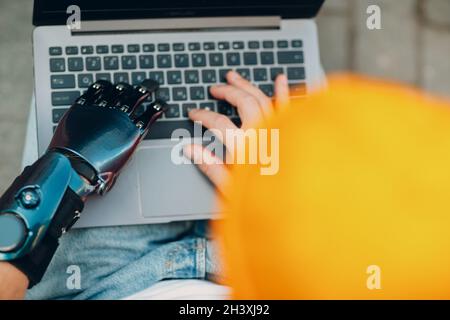 Young disabled man with artificial prosthetic hand using typing on laptop computer keyboard. Stock Photo