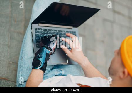 Young disabled man with artificial prosthetic hand using typing on laptop computer keyboard. Stock Photo