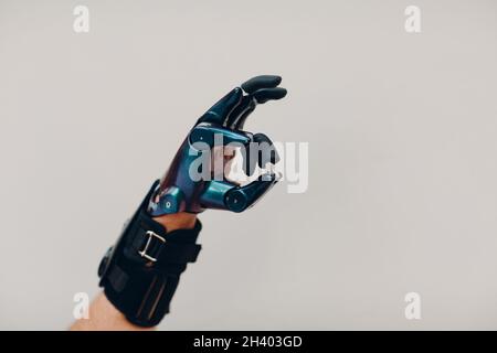 Young disabled man with artificial prosthetic hand in casual clothes. Stock Photo