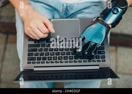 Young disabled man with artificial prosthetic hand using typing on laptop computer keyboard. Stock Photo