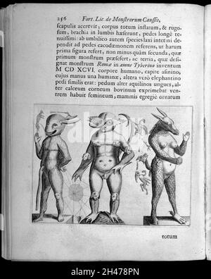 Three human figures with abnormalities Stock Photo - Alamy