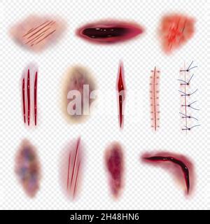 Body bruises. Injured realistic wound bloody gashes cuts and scars decent vector isolated set Stock Vector