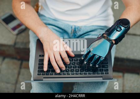 Young disabled man with artificial prosthetic hand using typing on laptop computer keyboard Stock Photo