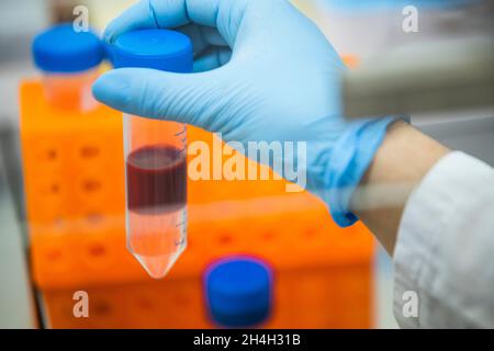 Medical laboratory assistant holding a centrifuge tube with blood, Essen, North Rhine-Westphalia, Germany Stock Photo