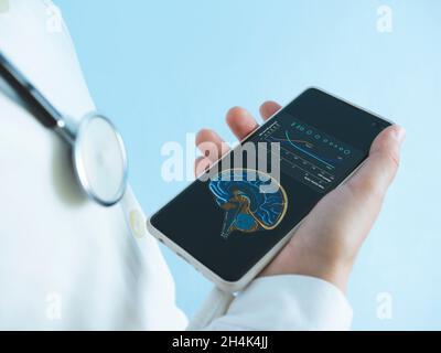 neurologist, brain, Medicine doctor with stethoscope using mobile smart phone, autoregulation curve blood pressure, partial pressure of oxygen, carbon Stock Photo