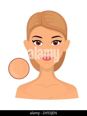 Woman different types of normal skin, enlarged area for cosmetology. Acne, wrinkles and age spots. Stock Vector