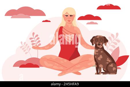 Young blonde woman with vitiligo skin problems. Body positive, self-love, depifmentation disease. Stock Vector