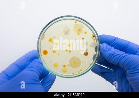 Scientist holds in his hands a petri dish with multi-colored bacteria from the environment, the isolation of dangerous bacteria in the laboratory. Iso Stock Photo