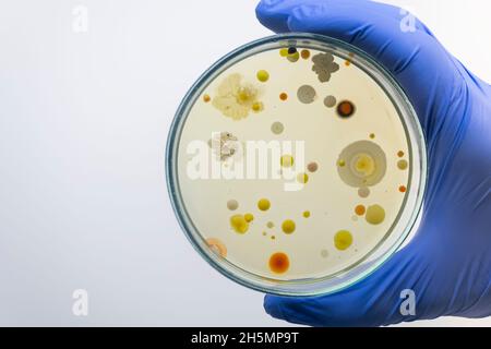 Close-up, a scientist holds in his hand a Petri dish with different colored colonies of bacteria, the isolation of bacteria from the air, a bacterial Stock Photo