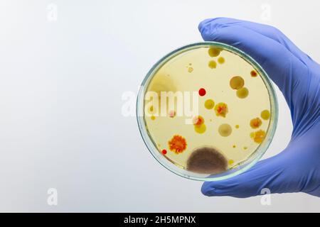 A petri dish with multi-colored bacteria, bacilli, mold and staphylococcus in the hand of a scientist in the laboratory. Stock Photo