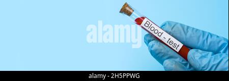Hand Holding Blood in Test tube on Blue Background. The concept of Medicine and Analysis. Copy space. Stock Photo