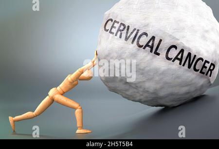 Cervical cancer - depiction, impression and presentation of this condition shown a wooden model pushing heavy weight to symbolize struggle and pain wh Stock Photo