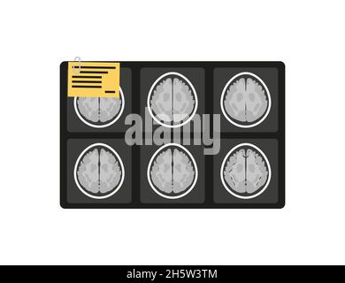 MRI x-ray brain picture in flat style, vector Stock Vector