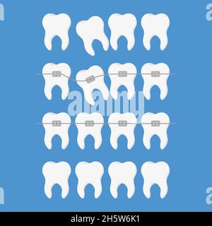 Teeth braces icon, cartoon style Stock Vector Image & Art - Alamy