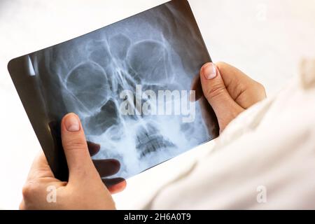 Magnetic resonance scan of a human brain with skull in doctor hands. MRI head scanning on light background in a hospital. X-ray research for desease o Stock Photo