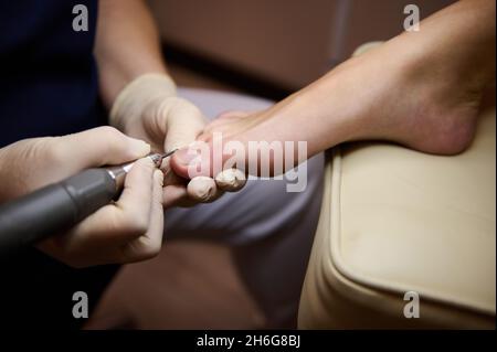 Professional hardware pedicure using electric machine.Patient on medical pedicure procedure, visiting podiatrist.Peeling feet with special electric de Stock Photo