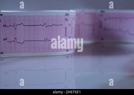 Close-up of a graph paper strip with black heart waves forming an electrocardiogram. Concept of study or medical test. Stock Photo