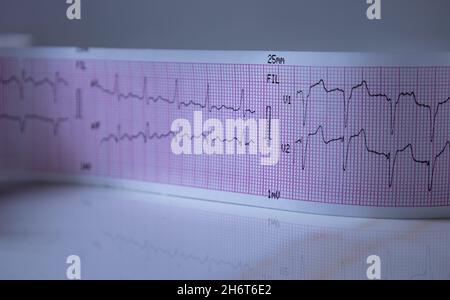 Close-up of a graph paper strip with black heart waves forming an electrocardiogram. Concept of study or medical test. Stock Photo