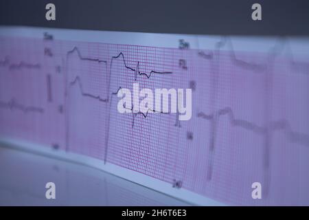 Close-up of a graph paper strip with black heart waves forming an electrocardiogram. Concept of study or medical test. Stock Photo