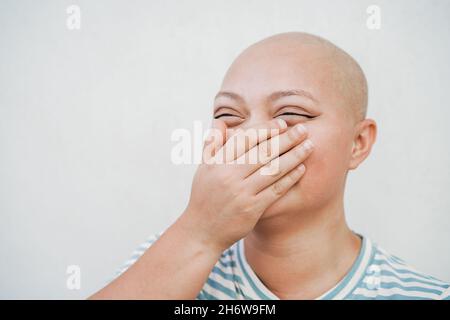 Cheerful bald girl smiling in front of camera - Focus on eyes Stock Photo