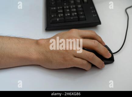 Ganglion cyst on man's hand. Hand holding computer mouse. Stock Photo