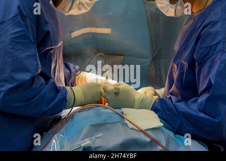 Process surgery of operation using medical equipment in operating room Stock Photo