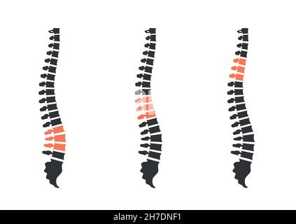 human spine silhouettes. back ache isolated on white Stock Vector