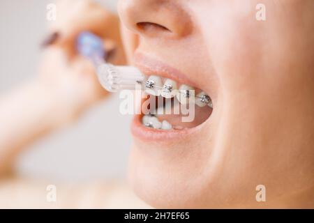 Young woman with braces on her teeth brushing her teeth with a toothbrush, close-up. Stock Photo