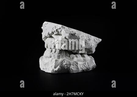 Cast of the jaw made of plaster on black background. Teeth cast for making braces. Dentist and orthodontist work Stock Photo